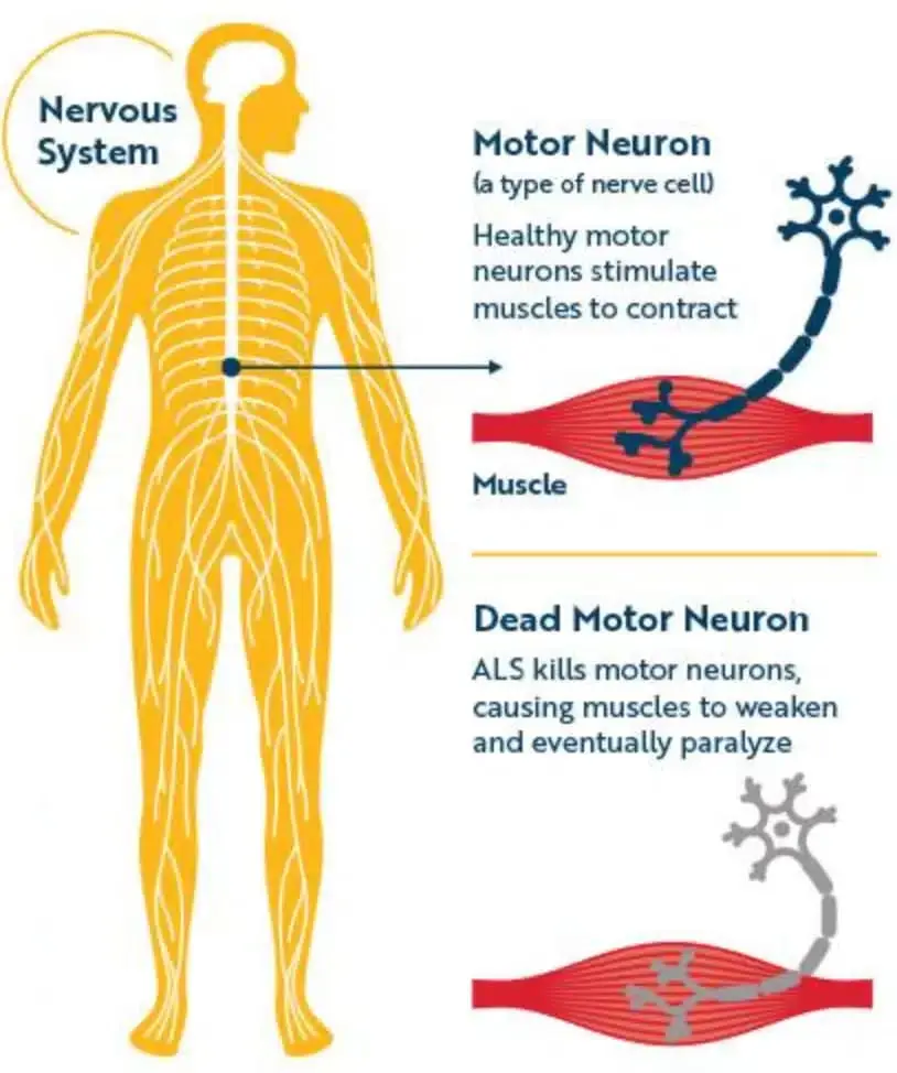 A diagram of the nervous system Describing the difference between a dead and active motor neuron